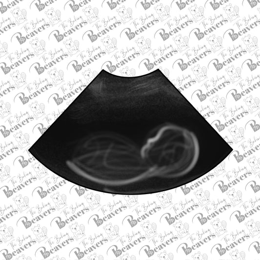 Ultrasound Cookie Cutter (recommend sizing up)